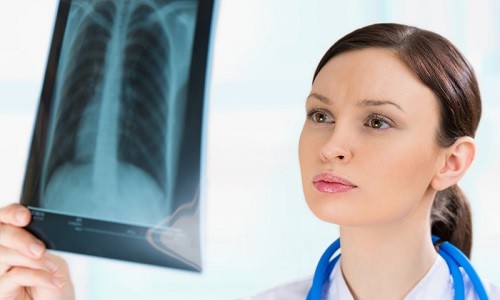 Необходимость рентгена при различных заболеваниях